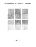 Method and a Kit To Detect Malignant Tumors and Provide a Prognosis diagram and image