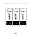 Method and a Kit To Detect Malignant Tumors and Provide a Prognosis diagram and image