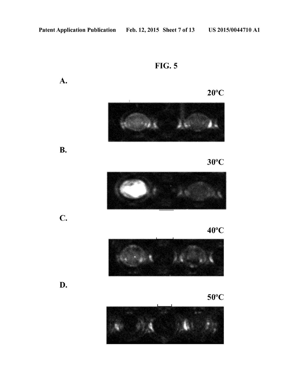 ENZYMATIC SENSORS AND METHODS FOR THEIR PREPARATION AND USE - diagram, schematic, and image 08