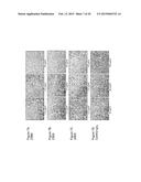 SIGLEC-15 ANTIBODIES IN TREATING BONE LOSS-RELATED DISEASE diagram and image