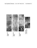 SIGLEC-15 ANTIBODIES IN TREATING BONE LOSS-RELATED DISEASE diagram and image