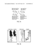 Hedgehog Pathway Inhibition for Cartilage Tumor and Metachondromatosis     Treatment diagram and image