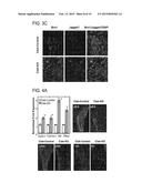 Hedgehog Pathway Inhibition for Cartilage Tumor and Metachondromatosis     Treatment diagram and image