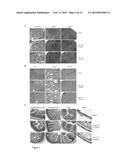 CURAXINS FOR USE IN TREATING BREAST CANCER AND METHOD FOR IDENTIFING     PATIENTS LIKELY TO RESPOND diagram and image