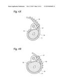 HYDRAULIC URETHRAL OCCLUSIVE DEVICE diagram and image