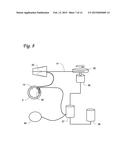 HYDRAULIC URETHRAL OCCLUSIVE DEVICE diagram and image