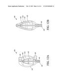 HYDRAULIC URETHRAL OCCLUSIVE DEVICE diagram and image