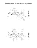 HYDRAULIC URETHRAL OCCLUSIVE DEVICE diagram and image