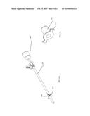 Intra-Thoracic Access Device Without Thoracotomy, and Related Methods diagram and image