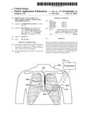 ROBUST RATE CALCULATION IN AN IMPLANTABLE CARDIAC STIMULUS OR MONITORING     DEVICE diagram and image