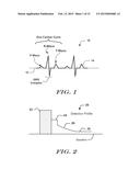 ROBUST RATE CALCULATION IN AN IMPLANTABLE CARDIAC STIMULUS OR MONITORING     DEVICE diagram and image