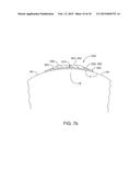 PATCH AND PATCH ASSEMBLY FOR IONTOPHORETIC TRANSDERMAL DELVERY OF ACTIVE     AGENTS FOR THERAPEUTIC AND MEDICINAL PURPOSES diagram and image