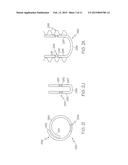 IMPLANT DEVICE WITH SPINE AND C-RING AND METHOD OF MAKING, DELIVERING, AND     USING SAME diagram and image