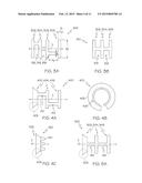 IMPLANT DEVICE WITH SPINE AND C-RING AND METHOD OF MAKING, DELIVERING, AND     USING SAME diagram and image