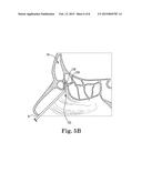 ELECTROSURGICAL DEVICE AND METHOD diagram and image