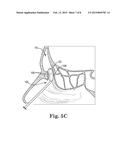 ELECTROSURGICAL DEVICE AND METHOD diagram and image