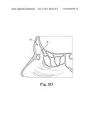 ELECTROSURGICAL DEVICE AND METHOD diagram and image