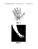 ORTHOPEDIC FASTENER DEVICE diagram and image