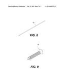 ORTHOPEDIC FASTENER DEVICE diagram and image