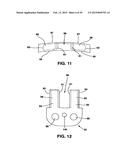 Static Compression Device diagram and image