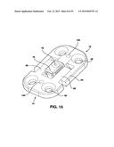 Static Compression Device diagram and image