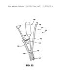 Static Compression Device diagram and image