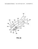 Static Compression Device diagram and image