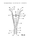 Static Compression Device diagram and image