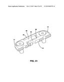 Static Compression Device diagram and image