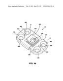 Static Compression Device diagram and image