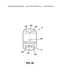 Static Compression Device diagram and image