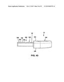 Static Compression Device diagram and image