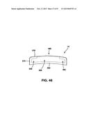 Static Compression Device diagram and image