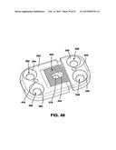 Static Compression Device diagram and image