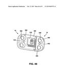 Static Compression Device diagram and image