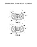 Static Compression Device diagram and image