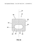 Static Compression Device diagram and image