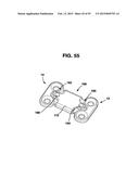 Static Compression Device diagram and image