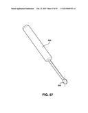 Static Compression Device diagram and image