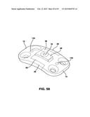 Static Compression Device diagram and image