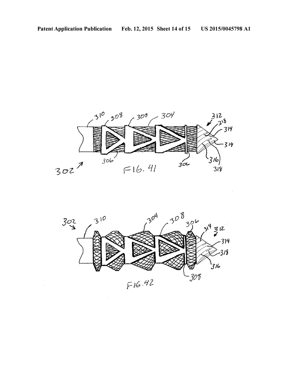 Device and Method For Manipulating Intervertebral Tissue - diagram, schematic, and image 15