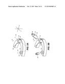 MACHINED SURGICAL GUIDE diagram and image