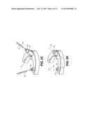 MACHINED SURGICAL GUIDE diagram and image