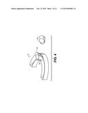 MACHINED SURGICAL GUIDE diagram and image