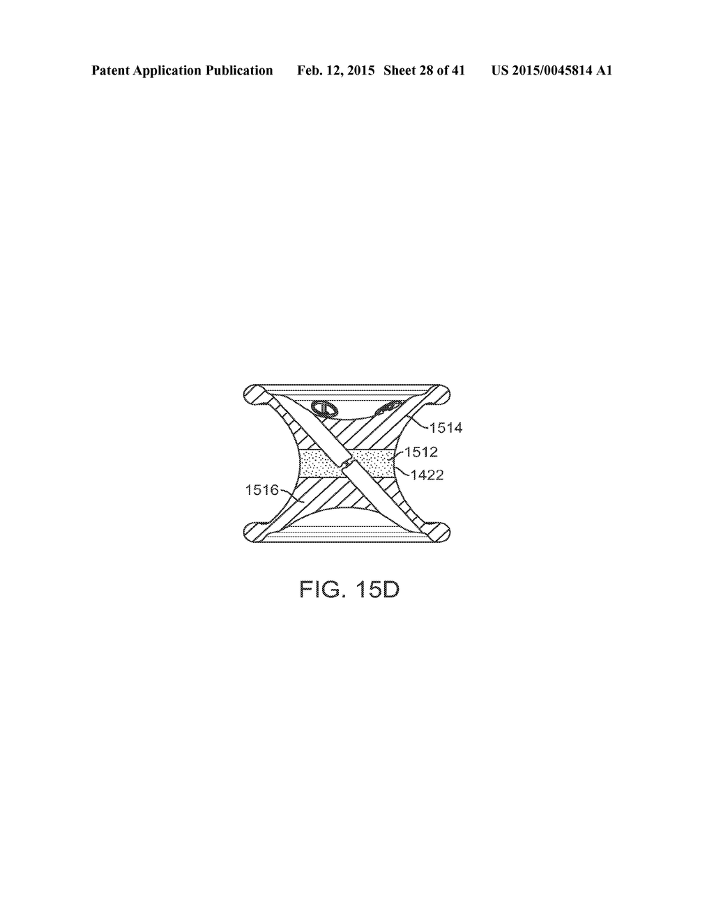 CURVED CANNULA SURGICAL SYSTEM CONTROL - diagram, schematic, and image 29