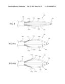 TISSUE EXPANSION DEVICES, SYSTEMS AND METHODS diagram and image