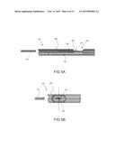 TISSUE EXPANSION DEVICES, SYSTEMS AND METHODS diagram and image