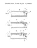 TISSUE EXPANSION DEVICES, SYSTEMS AND METHODS diagram and image