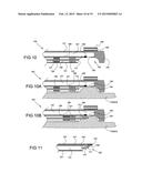 TISSUE EXPANSION DEVICES, SYSTEMS AND METHODS diagram and image