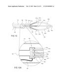 TISSUE EXPANSION DEVICES, SYSTEMS AND METHODS diagram and image